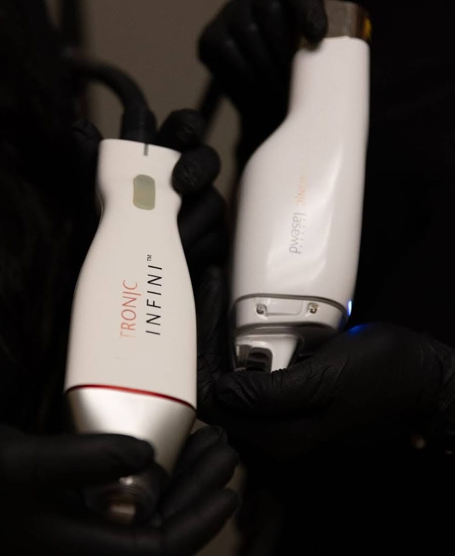 Microneedling for glowing face skin